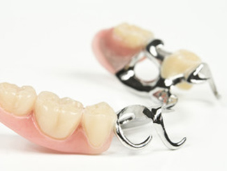 従来の金属で支える入れ歯