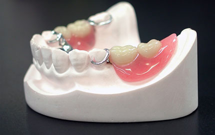 保険適用の入れ歯