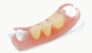 ジャストフィットデンチャー