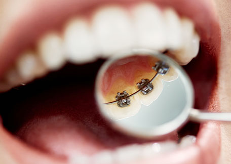 歯科矯正専門サイト