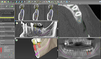 3Dシミュレーション