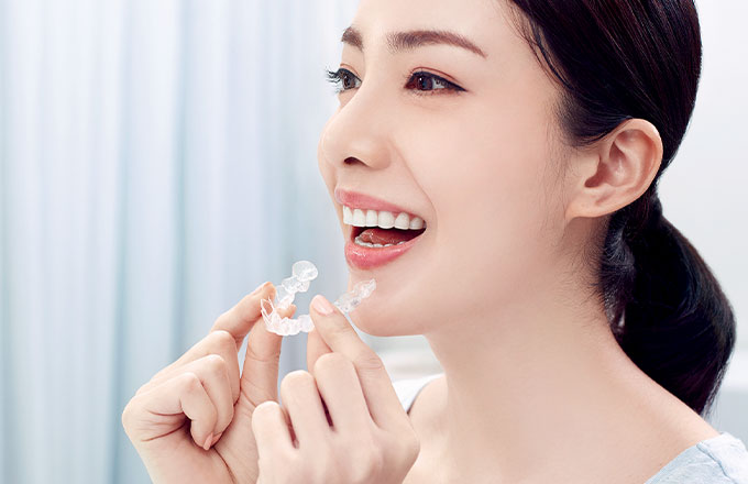 インビザライン