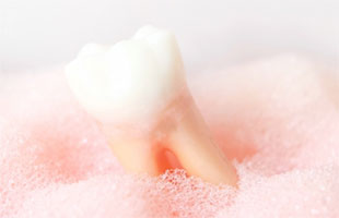 親知らずの抜歯